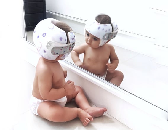 Bebê usando órtese craniana diante do espelho